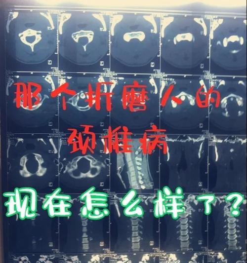 探讨自杀的心理因素及预防方法（揭示自杀的根源与挽救的希望）